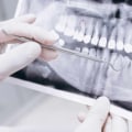 Is Dentistry Part of the Medical Field? A Comprehensive Guide