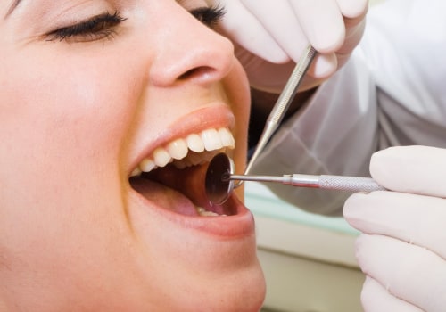 Can Dental Bonding Fall Off? - What You Need to Know